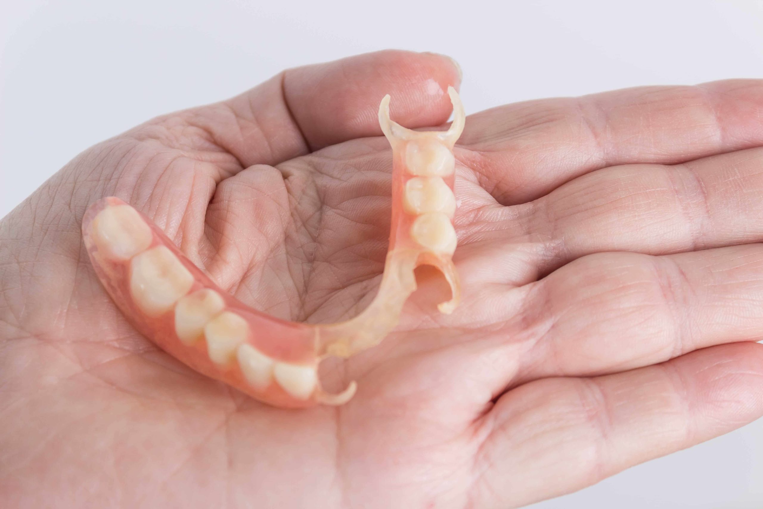 flexible nylon denture on fema