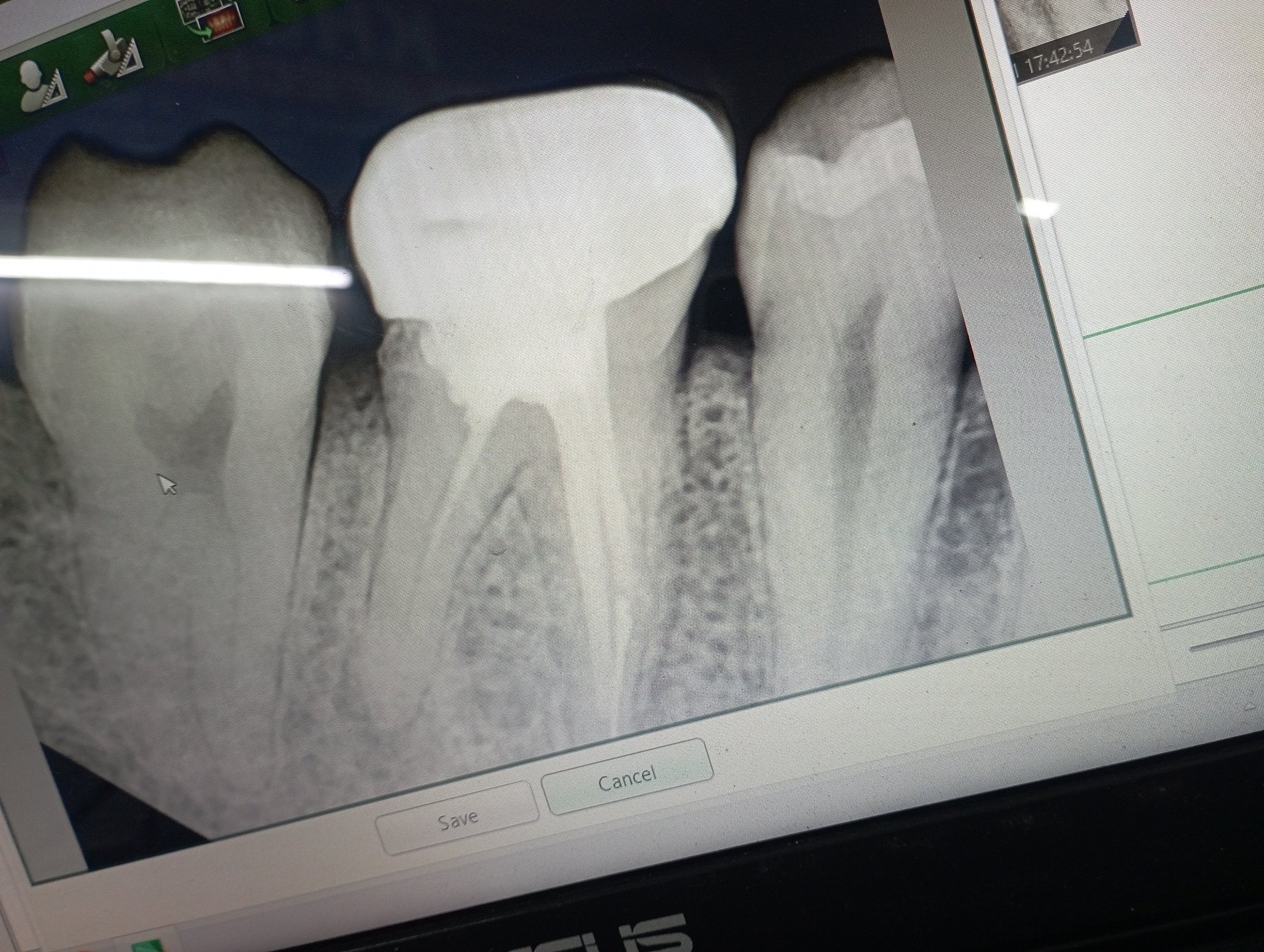 xray