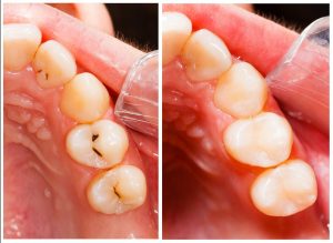 dental clinic Uttara Dhaka