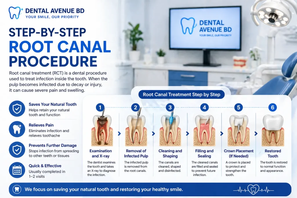 Painless Root Canal Treatment in Uttara Dhaka