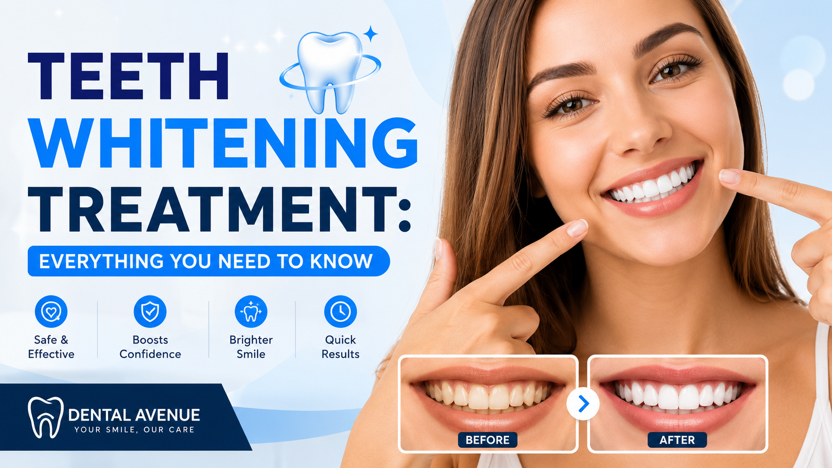 Teeth Whitening Treatment Everything You Need to Know